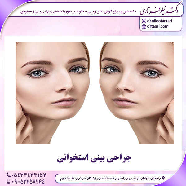 جراحی بینی استخوانی