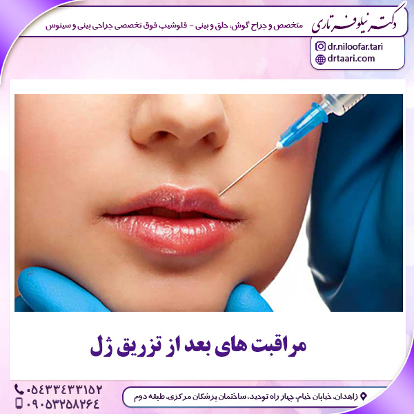 مراقبت های بعد از تزریق ژل