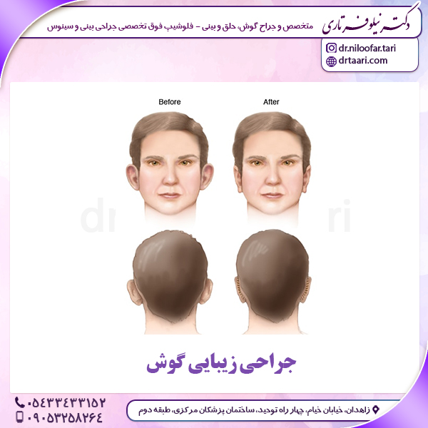 جراحی زیبایی گوش