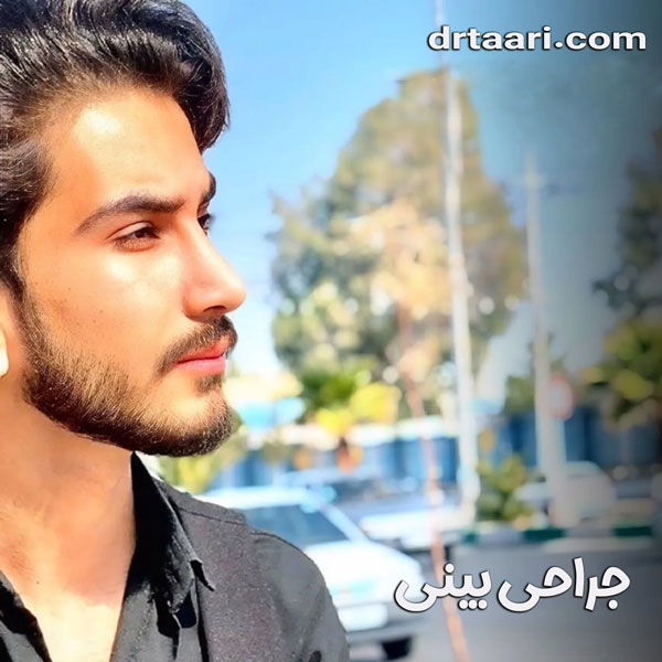 جراحی بینی از دکتر نیلوفر تاری ، بهترین جراح بینی زاهدان