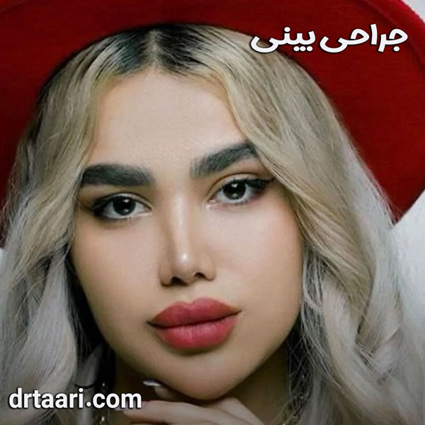 جراحی بینی از دکتر نیلوفر تاری ، بهترین جراح بینی زاهدان