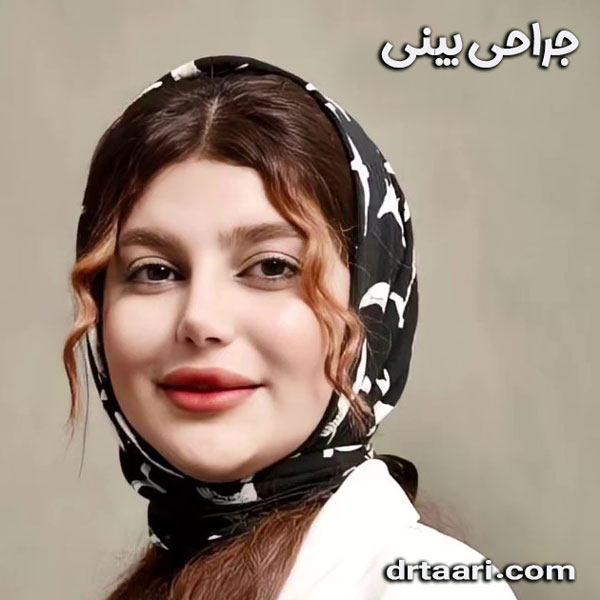 جراحی بینی از دکتر نیلوفر تاری ، بهترین جراح بینی زاهدان