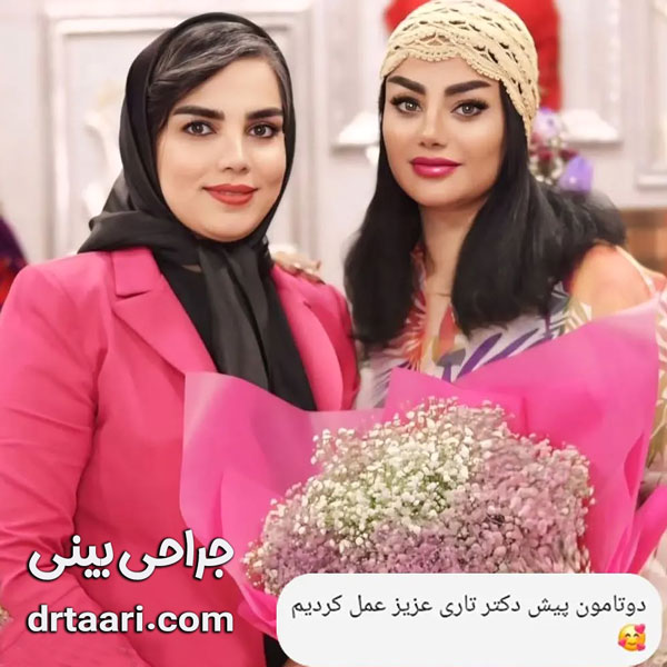 جراحی بینی از دکتر نیلوفر تاری ، بهترین جراح بینی زاهدان