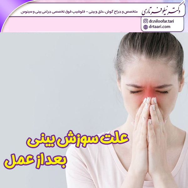 سوزش بینی بعد از عمل بینی با دکتر تاری