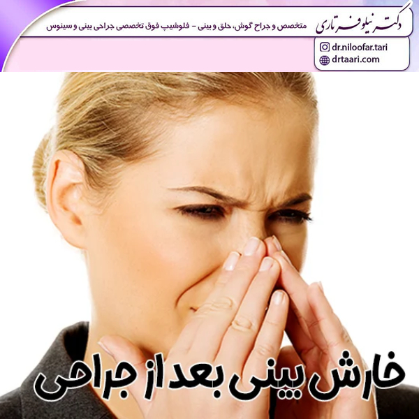خارش بینی بعد از عمل با دکتر تاری