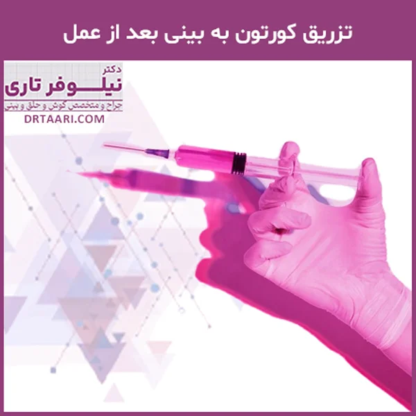 تزریق کورتون به بینی بعد از عمل - دکتر نیلوفر تاری