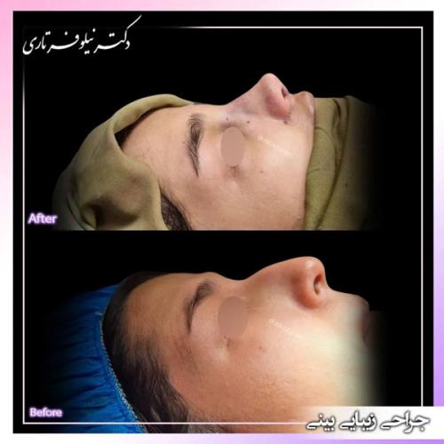 جراحی-بینی395