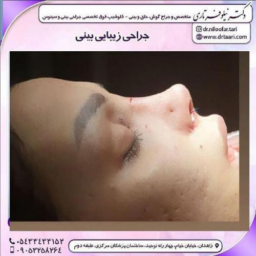 جراحی-بینی-123