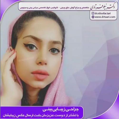 جراحی-بینی-131