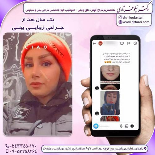 جراحی-بینی-222 (1)