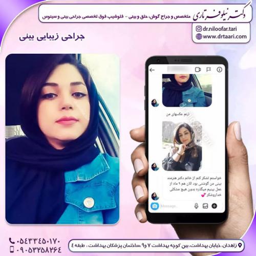 جراحی-بینی-228 (1)