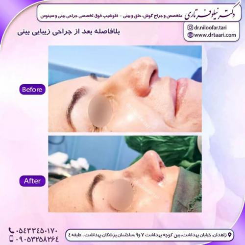 جراحی-بینی-236 (1)