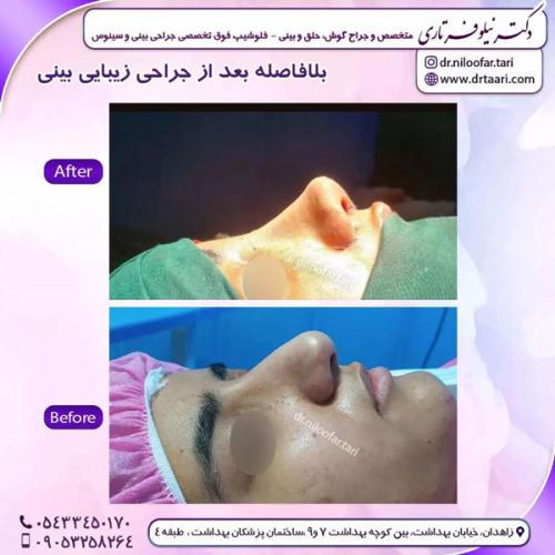 جراحی-بینی-240 (1)
