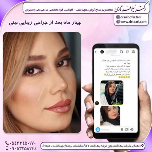 جراحی-بینی-246 (1)