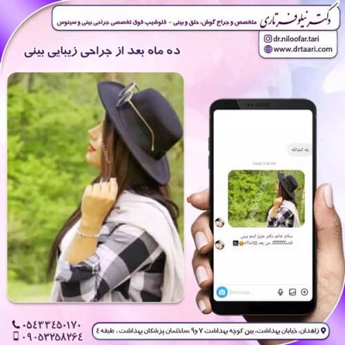 جراحی-بینی-247 (1)