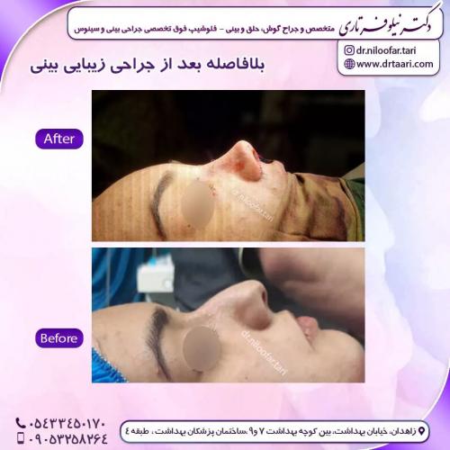 جراحی-بینی-256 (1) (1)