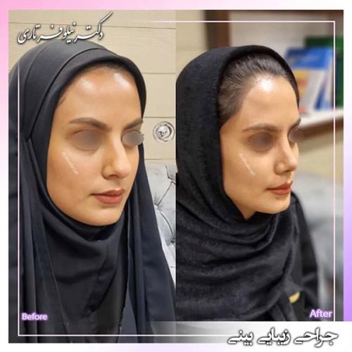 جراحی-بینی-400