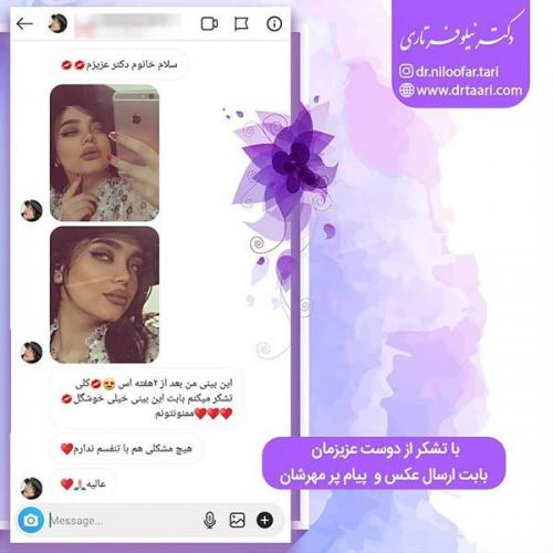 جراحی-بینی-98