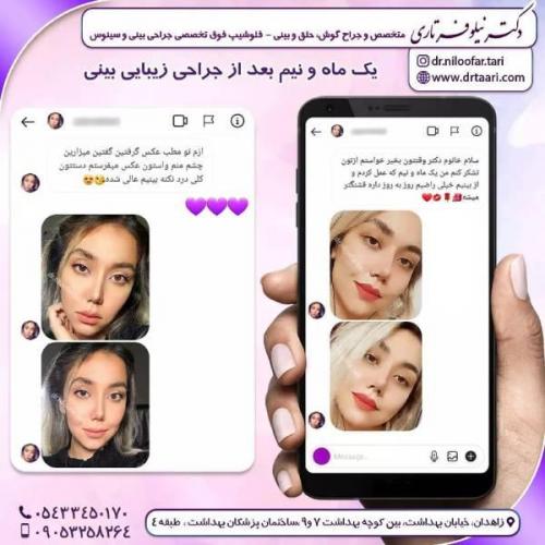 جراحی-بینی-زاهدان-112