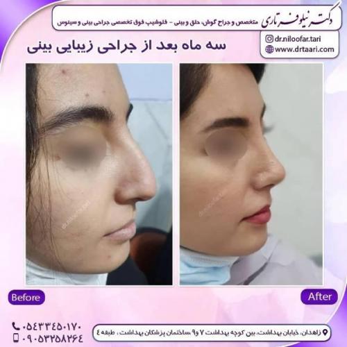 جراحی-بینی-زاهدان-88 