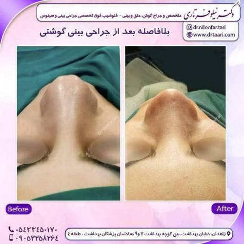 جراحی-بینی-زاهدان137