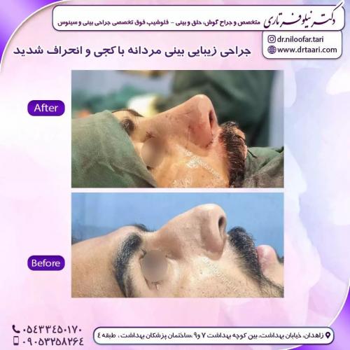 جراحی-بینی258