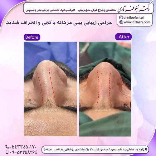 جراحی-بینی259