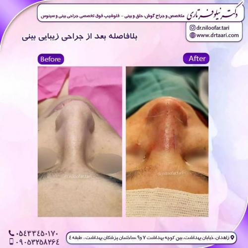 جراحی-بینی261