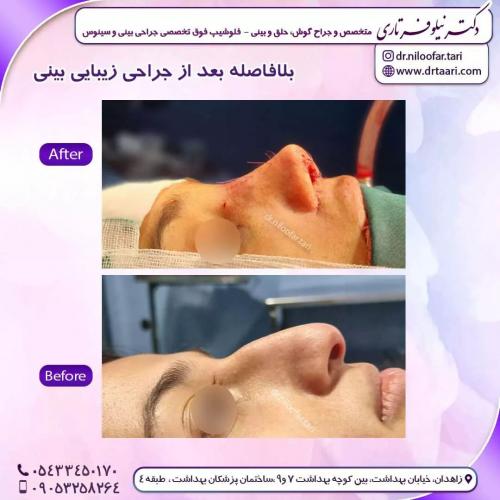 جراحی-بینی262