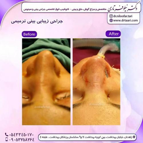 جراحی-بینی263