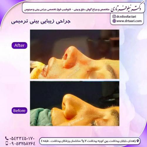 جراحی-بینی264