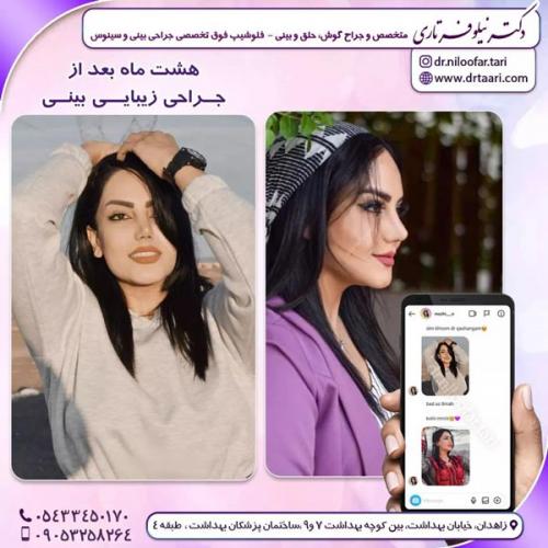 جراحی-بینی265