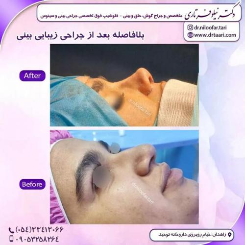جراحی-بینی266