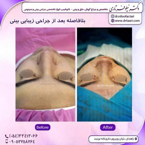 جراحی-بینی267