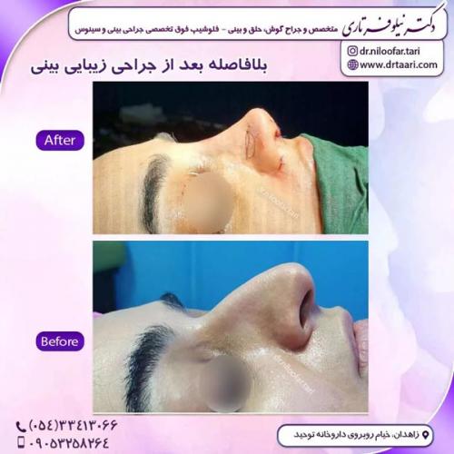 جراحی-بینی269 (1)