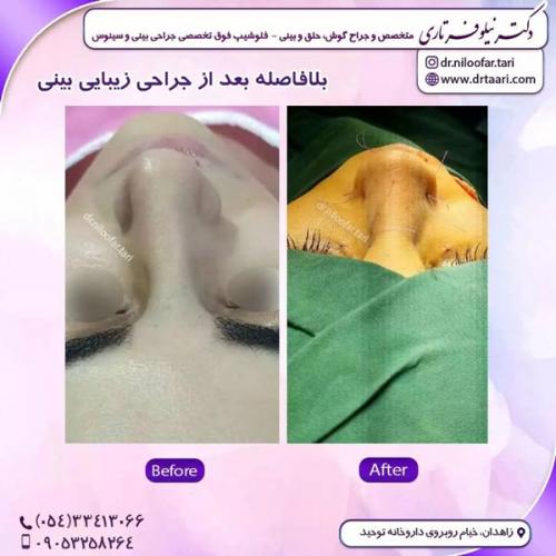 جراحی-بینی272