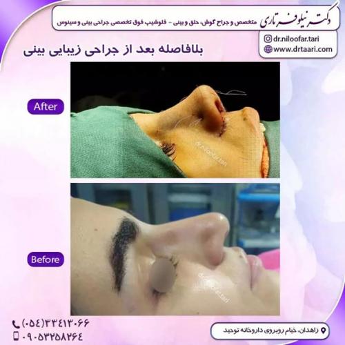 جراحی-بینی273