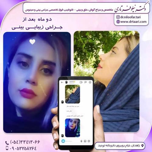 جراحی-بینی279