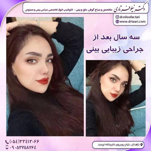 جراحی-بینی280