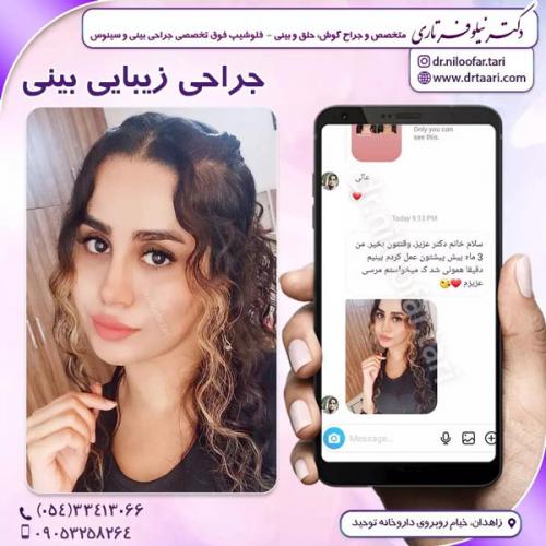 جراحی-بینی282