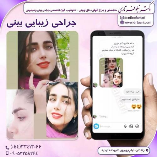 جراحی-بینی283