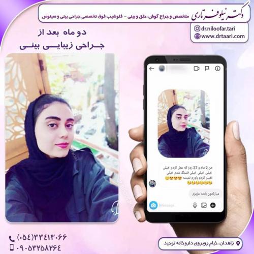 جراحی-بینی284