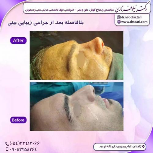جراحی-بینی285