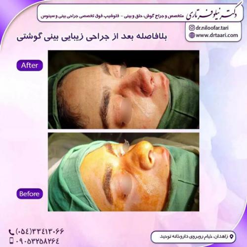 جراحی-بینی286