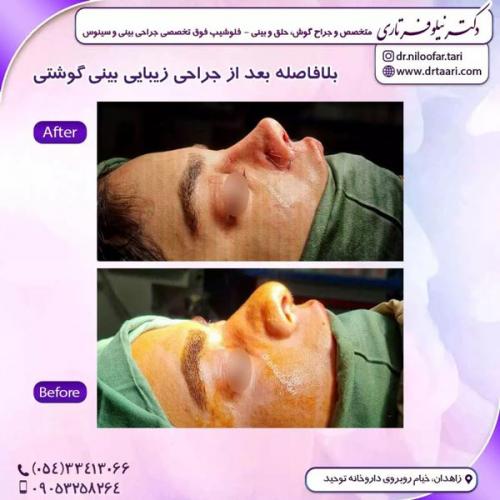 جراحی-بینی287