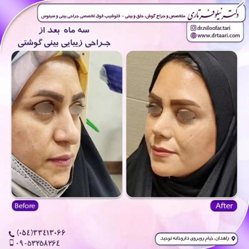 جراحی-بینی288