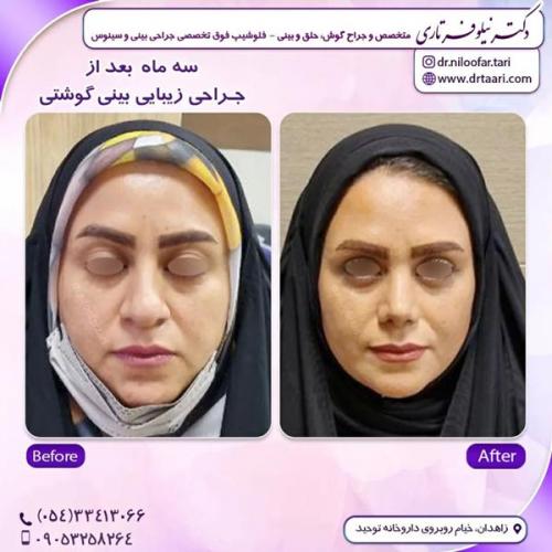جراحی-بینی289