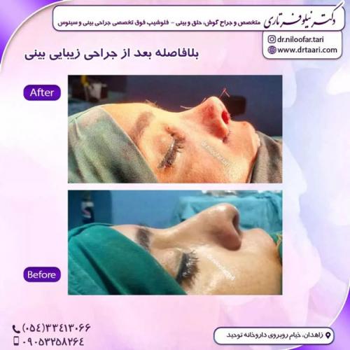 جراحی-بینی291
