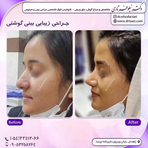 جراحی-بینی292