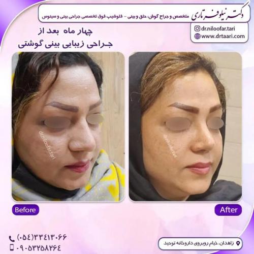 جراحی-بینی294